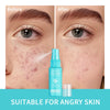 Hypochlorous Acid Facial Toner Spray