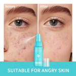 Hypochlorous Acid Facial Toner Spray