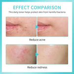 Hypochlorous Acid Facial Toner Spray